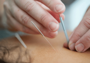 Traditional Chinese Medicine (TCM)