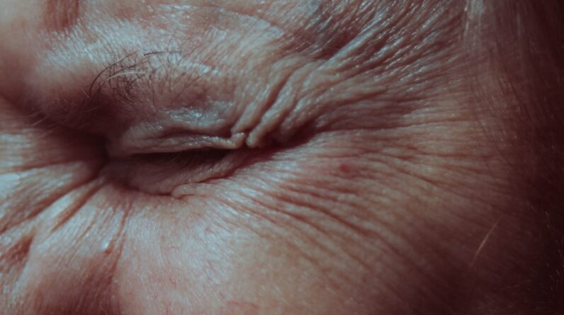 Photo Anti Aging Clinic